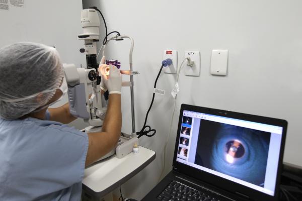 cornea1
