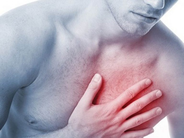 infarto