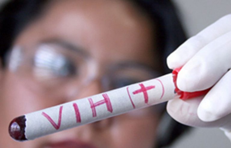 HIV