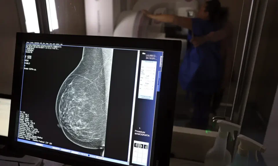 Mulher realiza exame de mamografia durante campanha Outubro Rosa